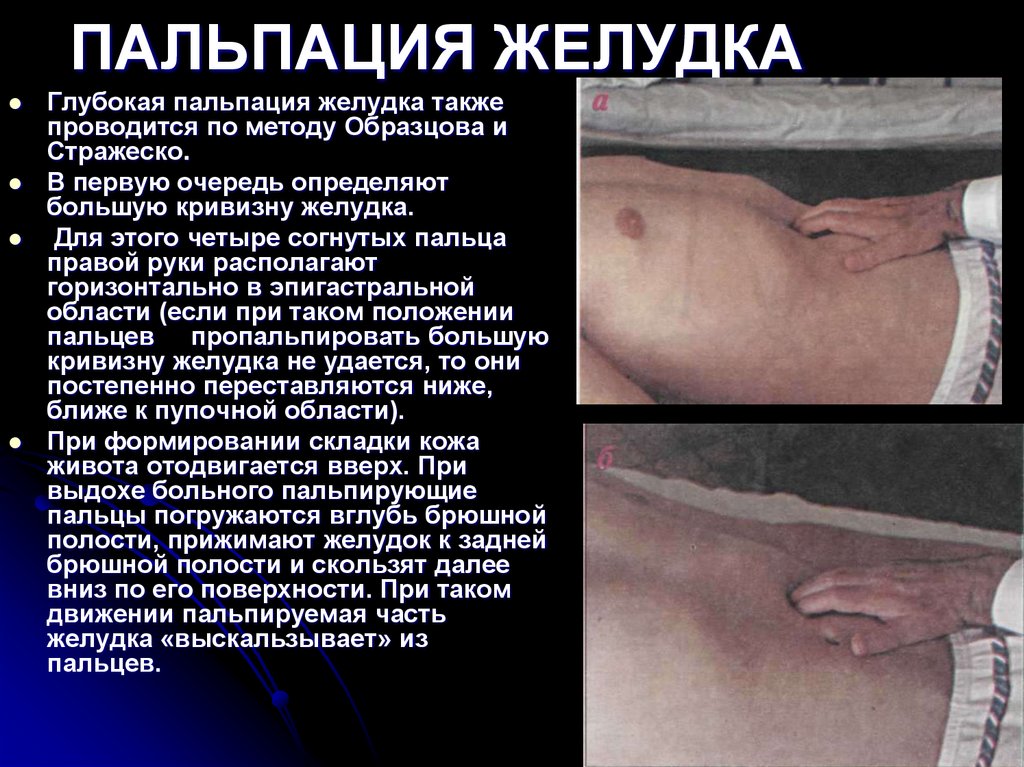 ПАЛЬПАЦИЯ ЖЕЛУДКА