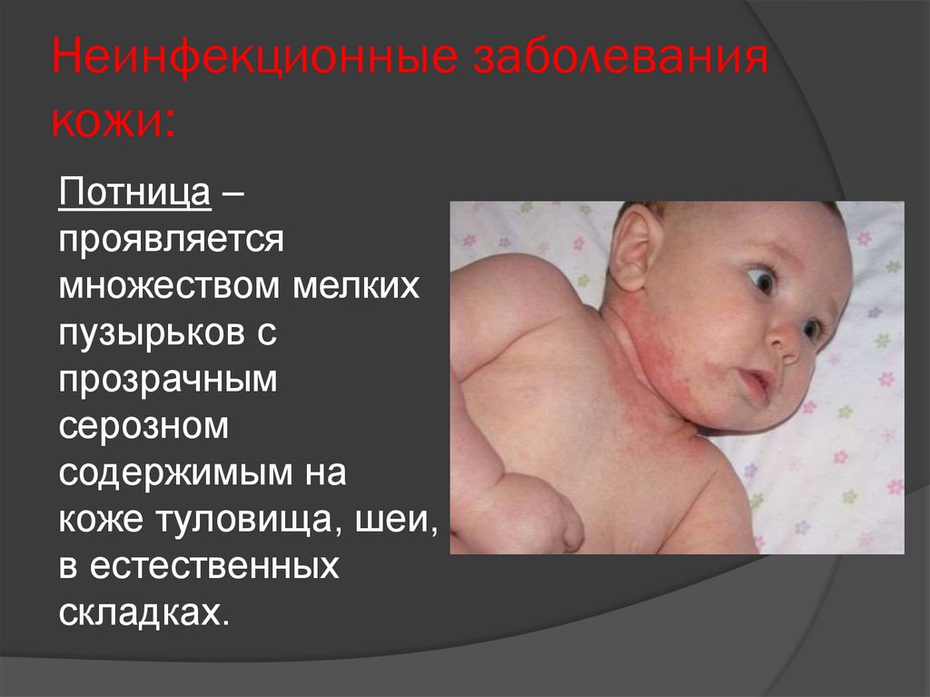 Неинфекционные заболевания кожи: