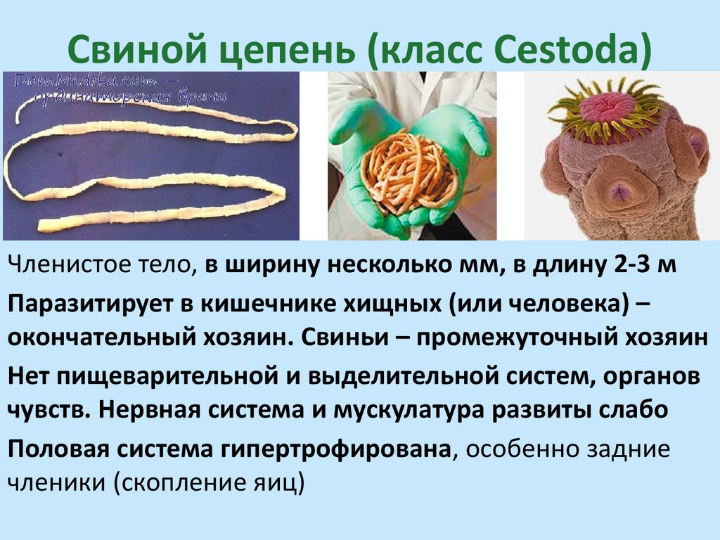 Свиной цепень (класс Cestoda)