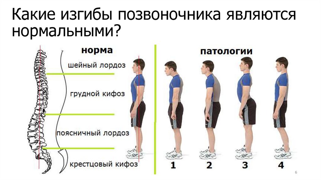 Какие изгибы позвоночника являются нормальными?
