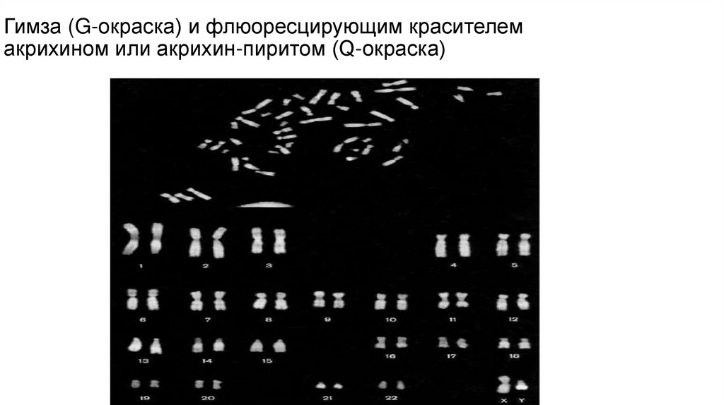 Гимза (G-окраска) и флюоресцирующим красителем акрихином или акрихин-пиритом (Q-окраска)