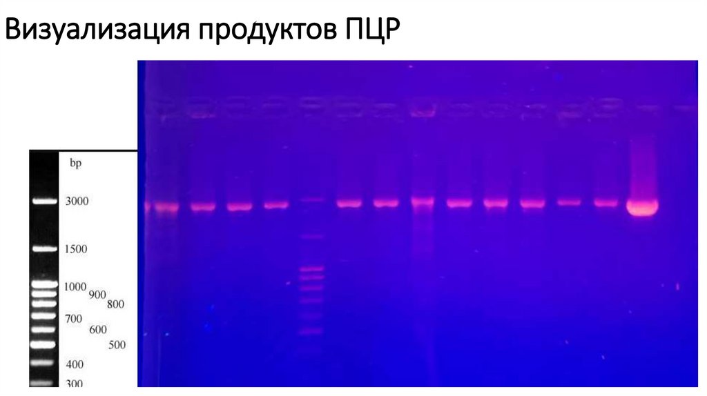 Визуализация продуктов ПЦР