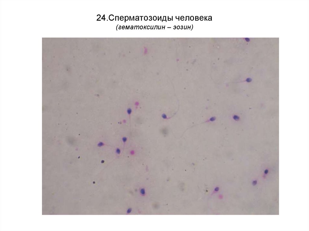 24.Сперматозоиды человека (гематоксилин – эозин)