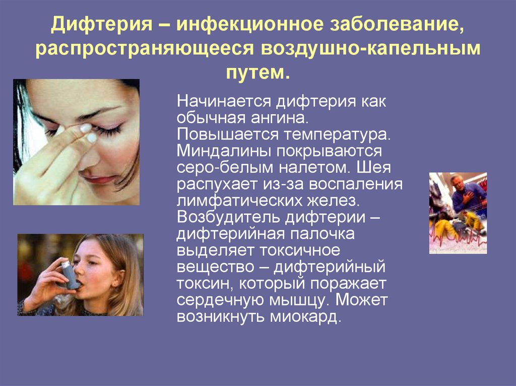 Дифтерия – инфекционное заболевание, распространяющееся воздушно-капельным путем.