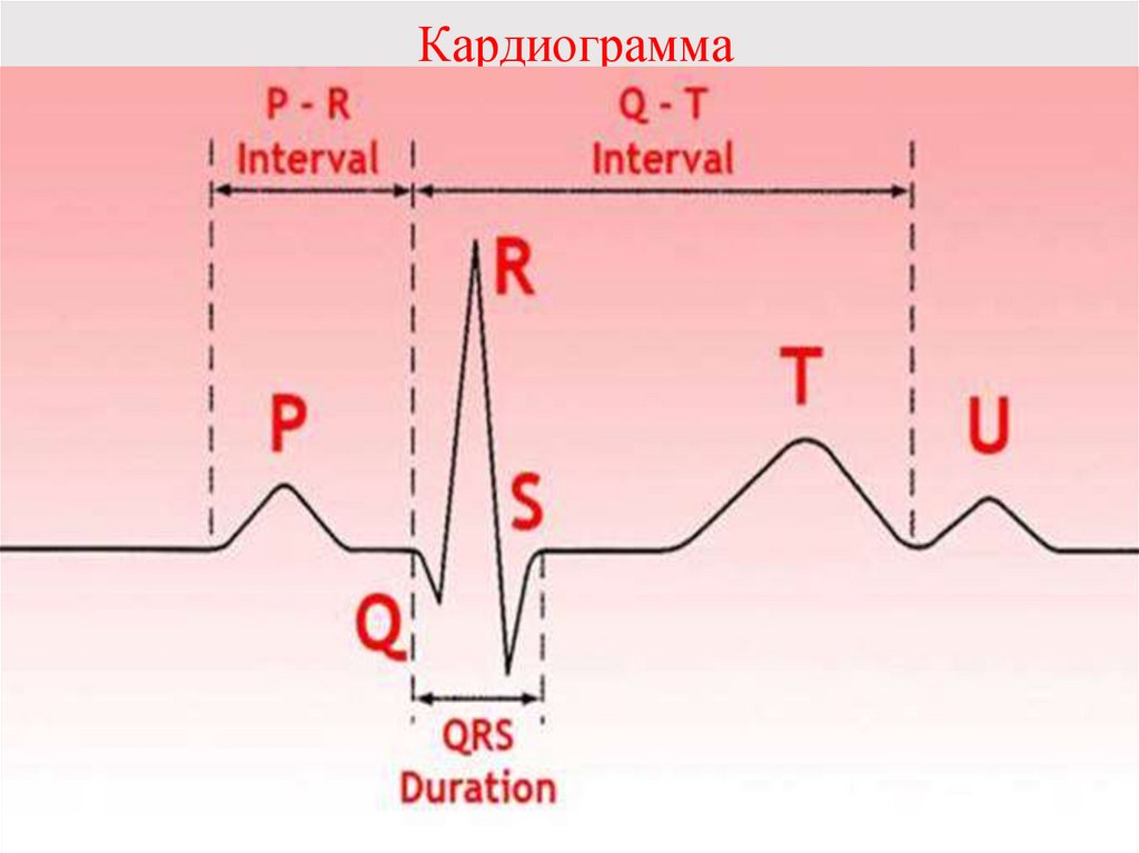 Кардиограмма