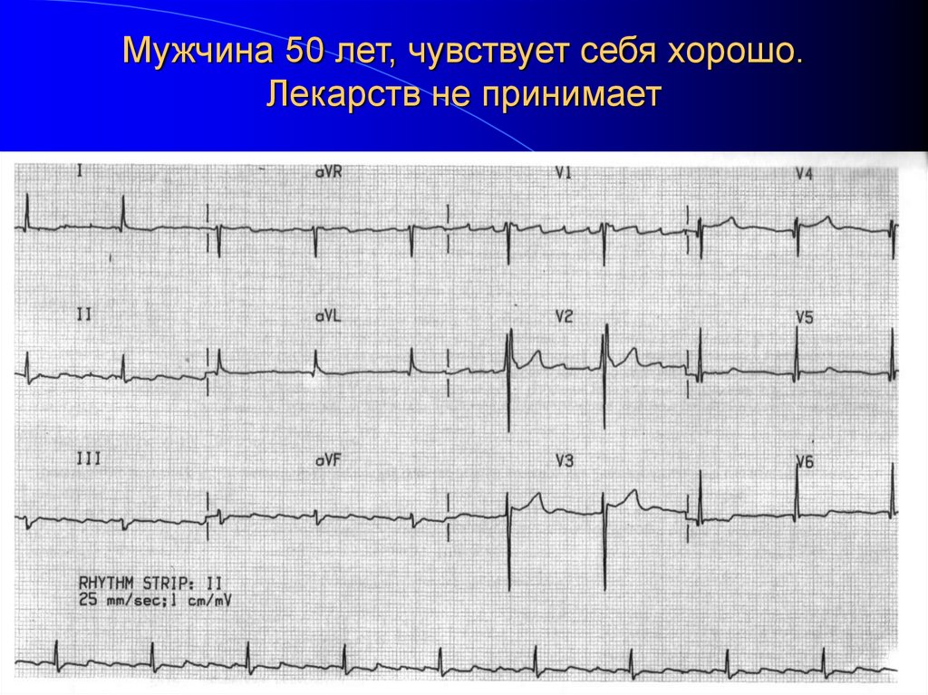 Мужчина 50 лет, чувствует себя хорошо. Лекарств не принимает