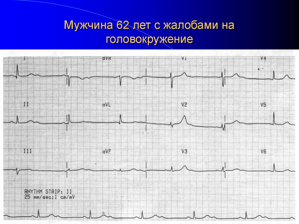 Мужчина 62 лет с жалобами на головокружение