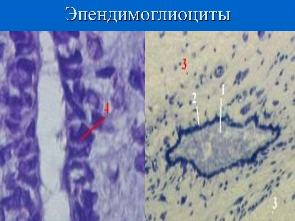 Эпендимоглиоциты