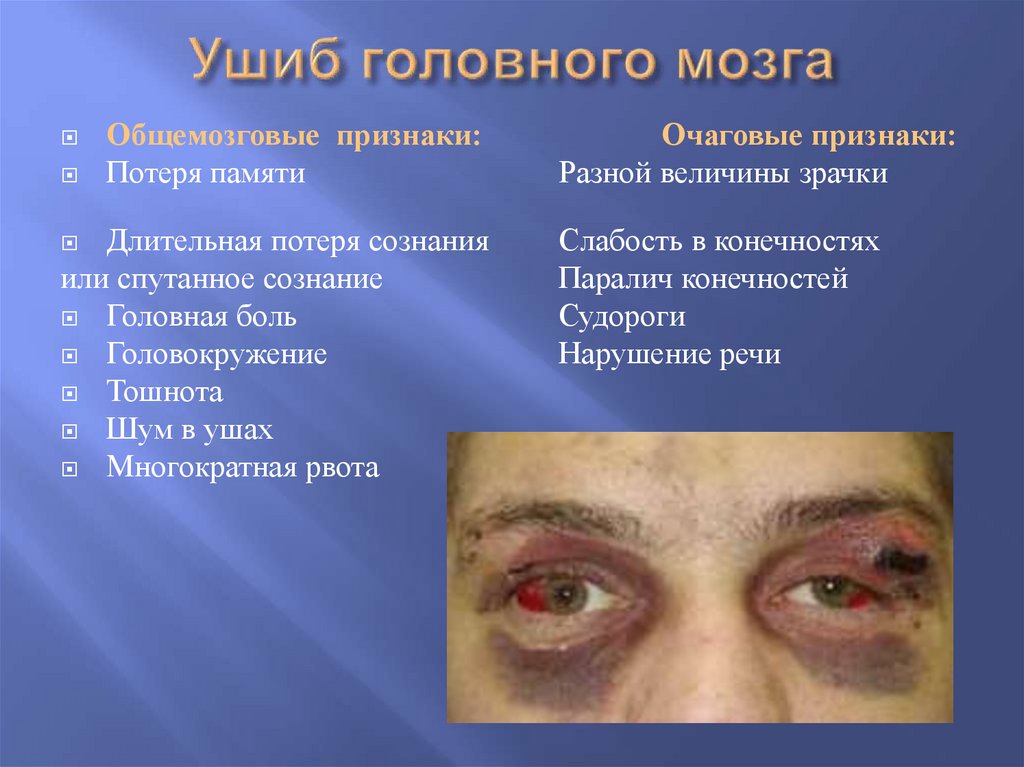 Ушиб головного мозга