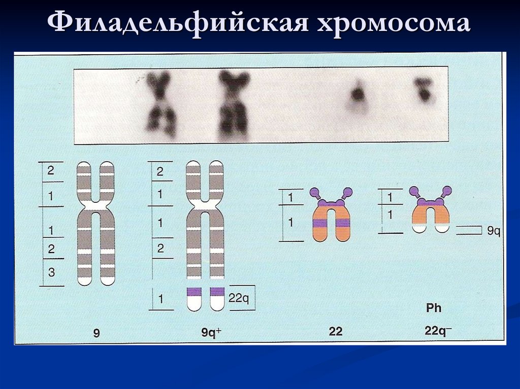 Филадельфийская хромосома