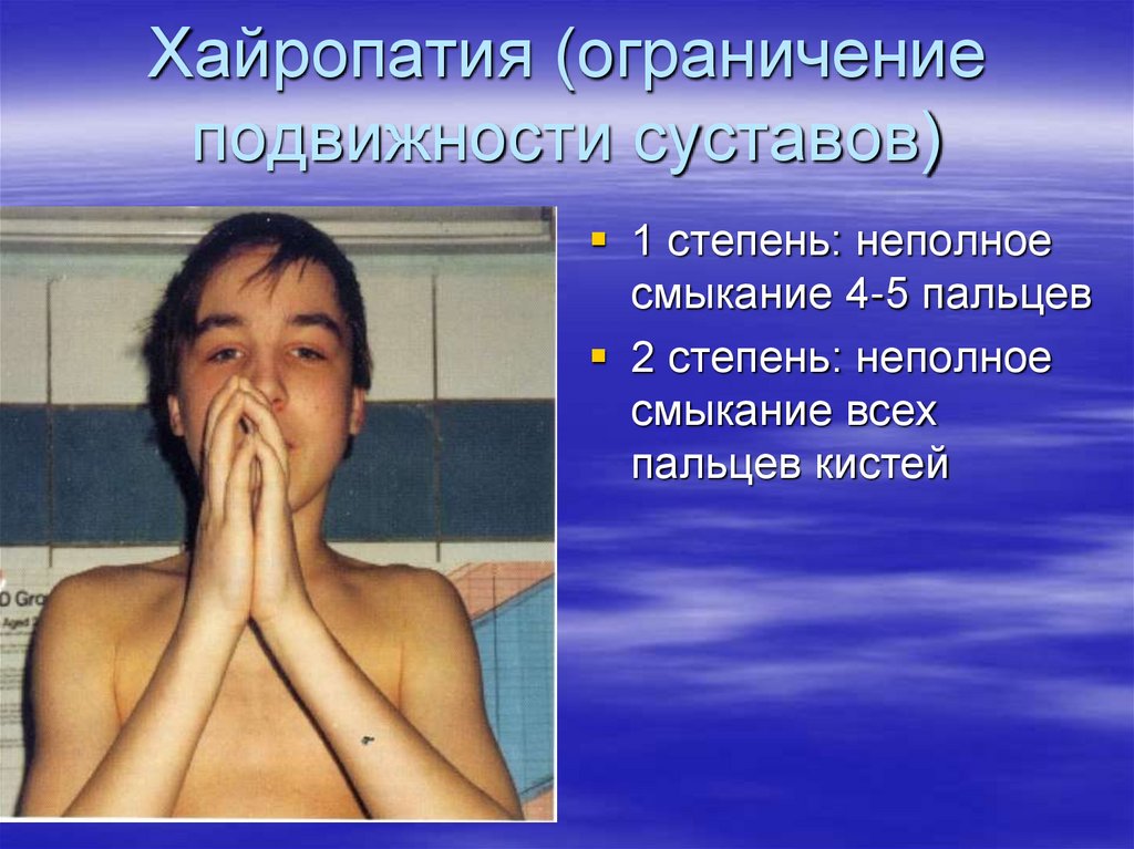 Хайропатия (ограничение подвижности суставов)