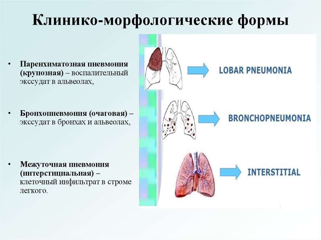 Клинико-морфологические формы