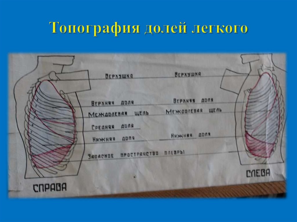 Топография долей легкого
