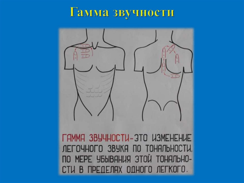 Гамма звучности