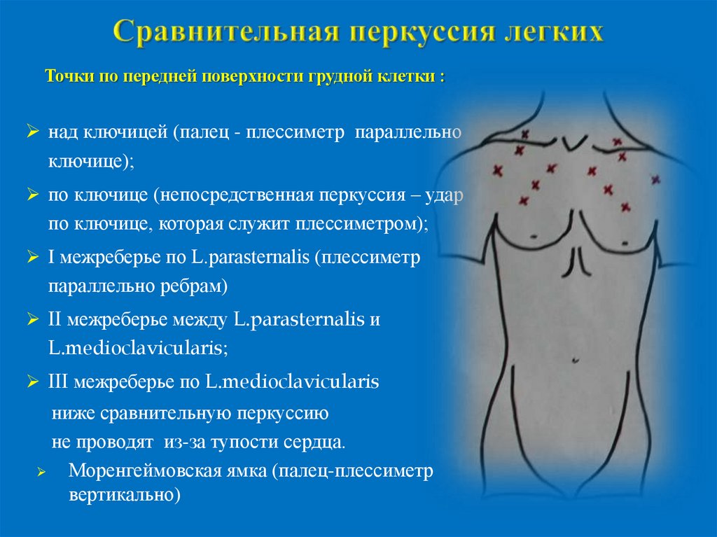Сравнительная перкуссия легких