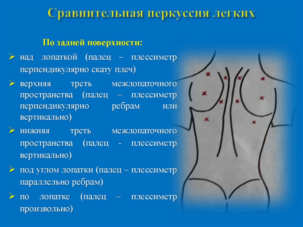Сравнительная перкуссия легких