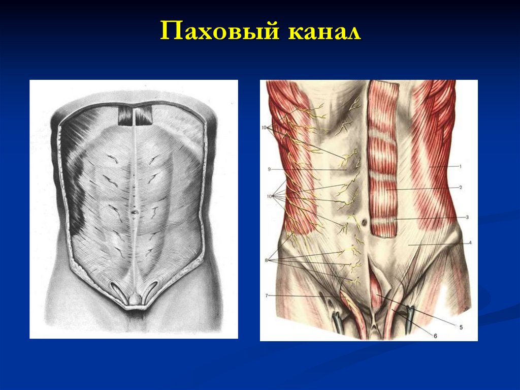 Паховый канал