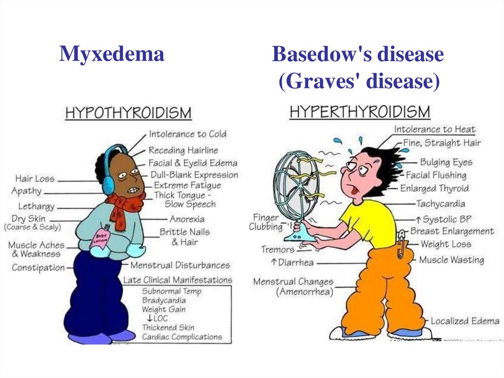 Basedow's disease (Graves' disease)