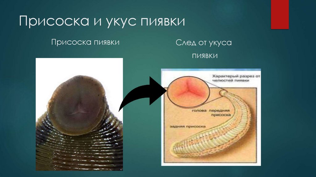 Присоска и укус пиявки