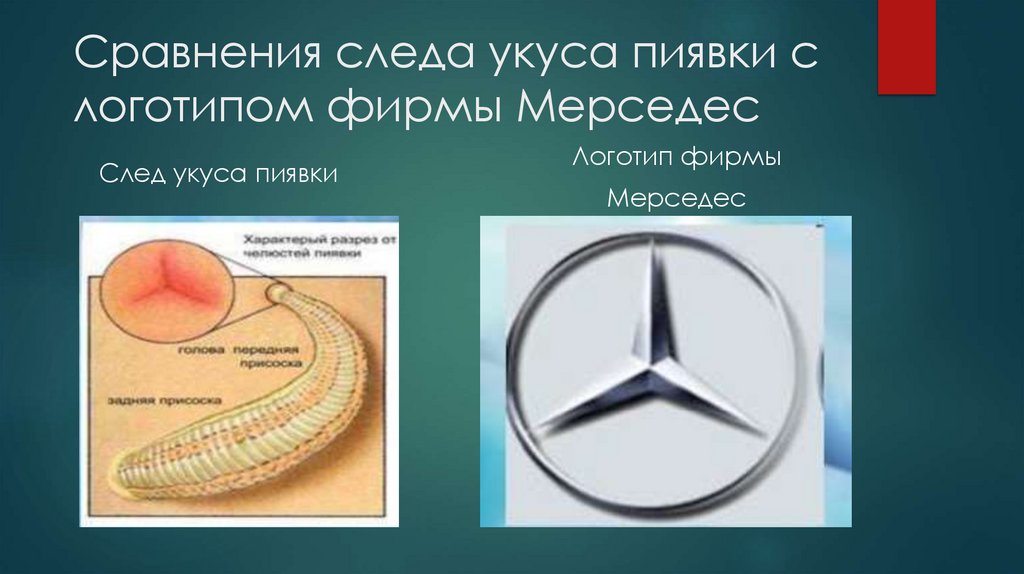 Сравнения следа укуса пиявки с логотипом фирмы Мерседес