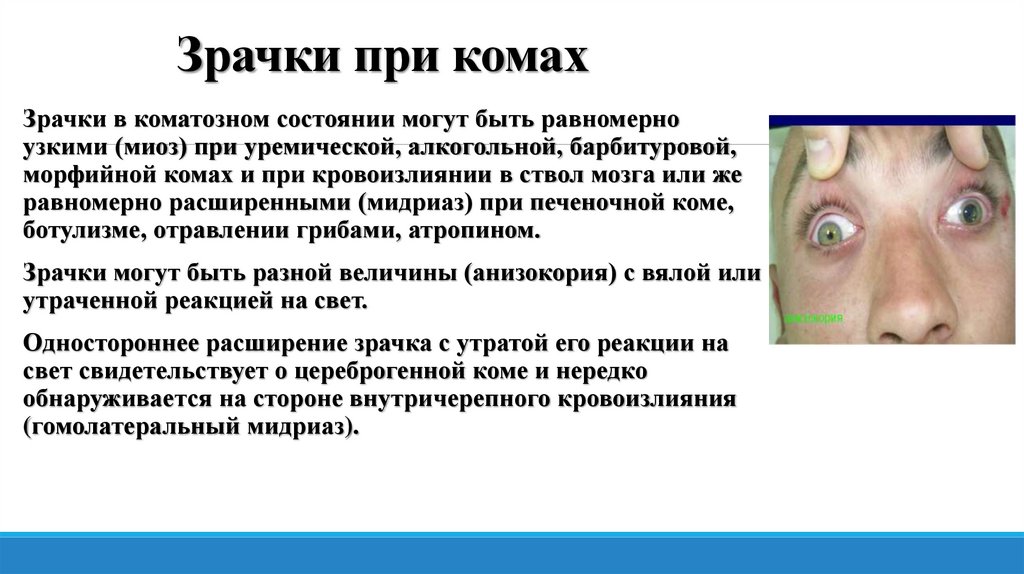 Зрачки при комах