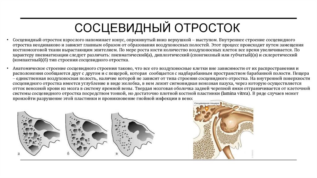Сосцевидный отросток