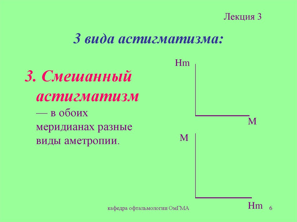 3 вида астигматизма: