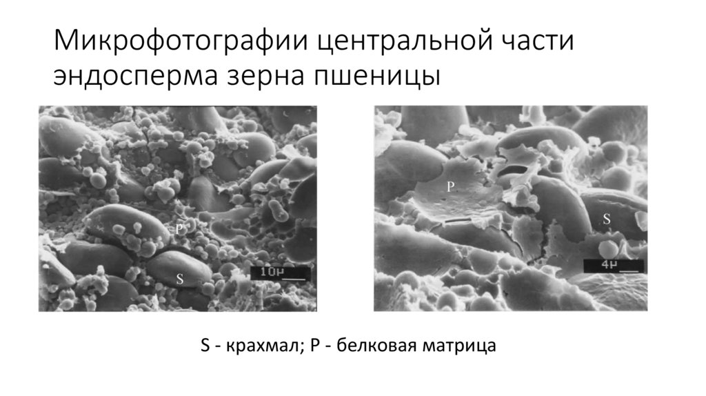 Микрофотографии центральной части эндосперма зерна пшеницы