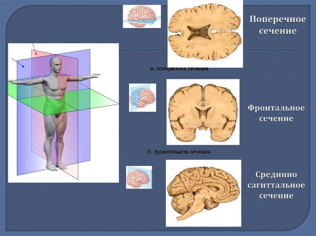 Поперечное сечение
