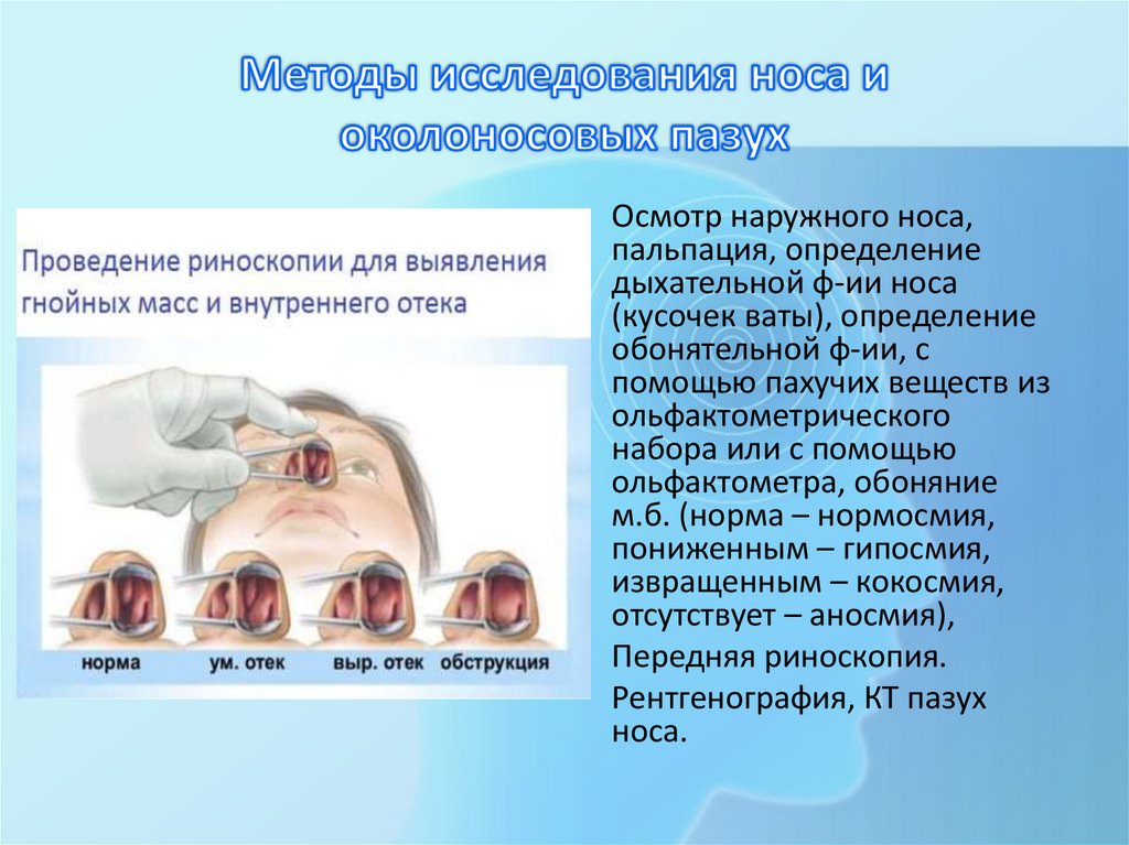Методы исследования носа и околоносовых пазух