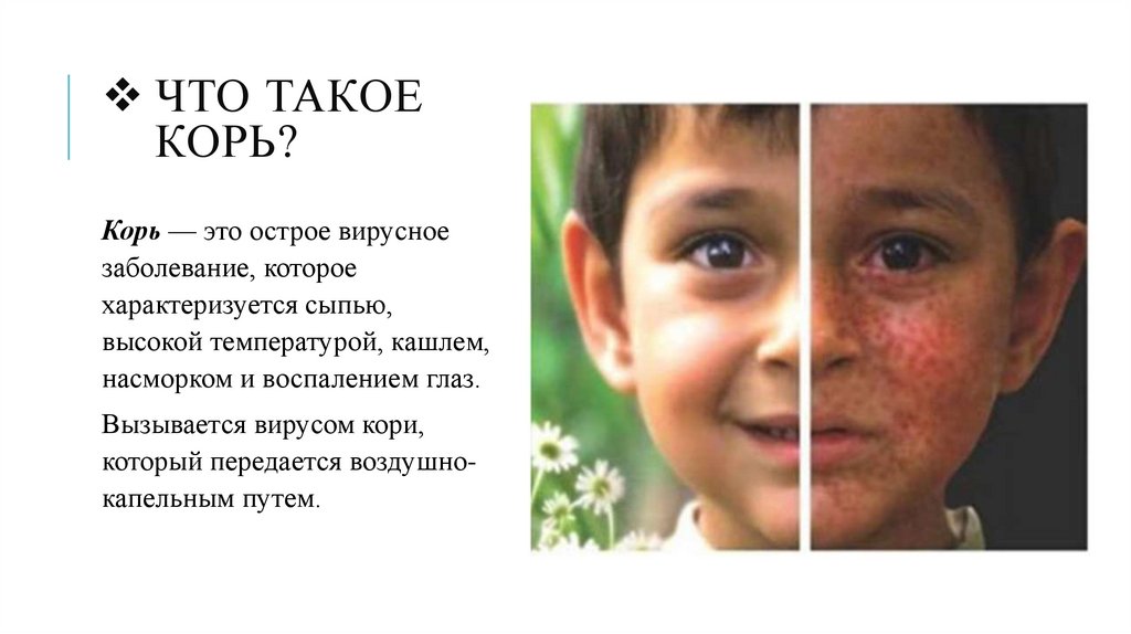 Что такое Корь?