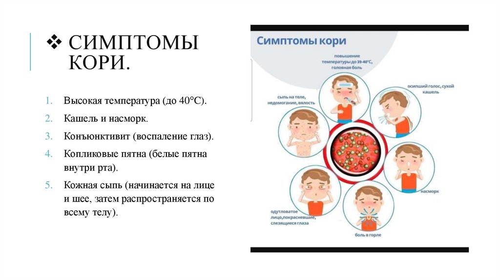 Симптомы Кори.