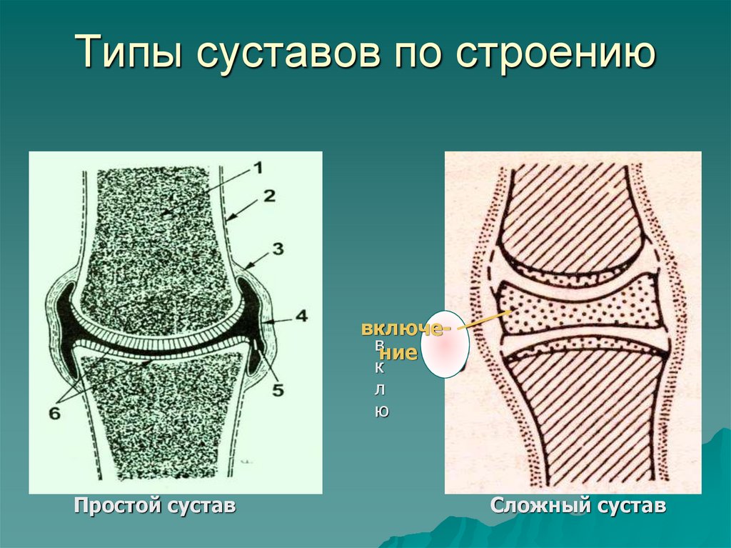 Типы суставов по строению
