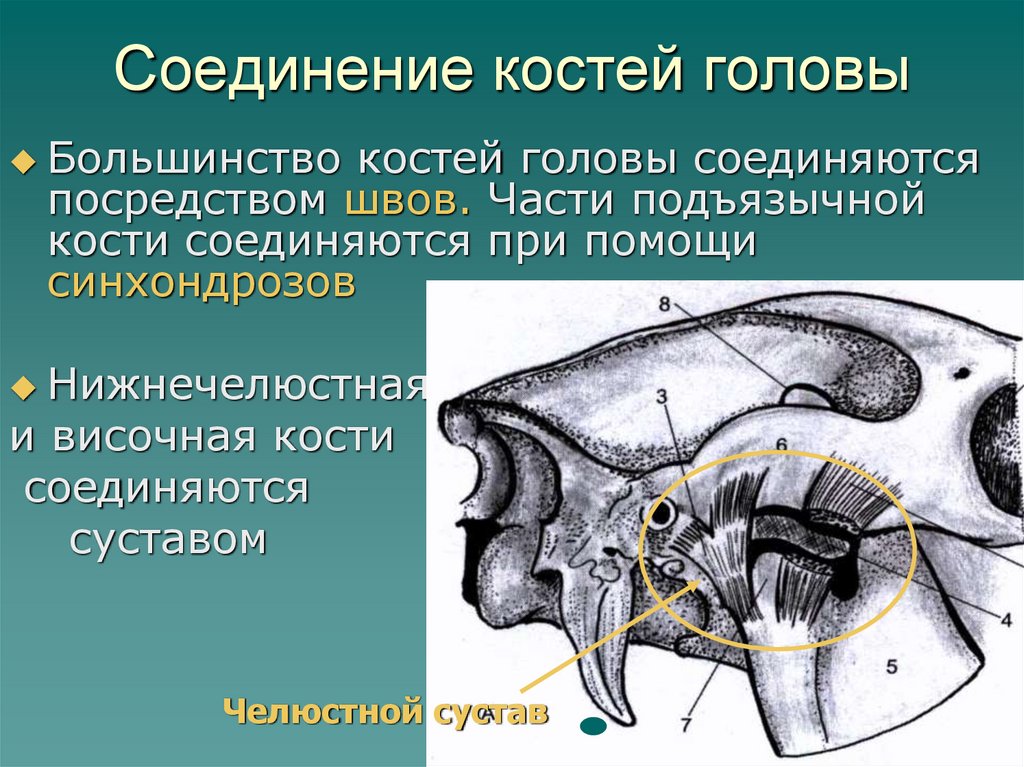 Соединение костей головы