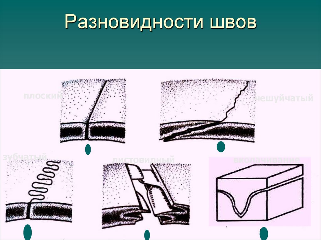 Разновидности швов