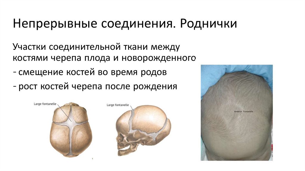 Непрерывные соединения. Роднички