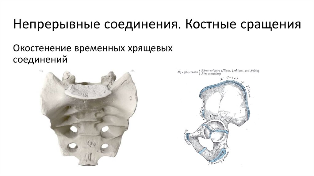 Непрерывные соединения. Костные сращения