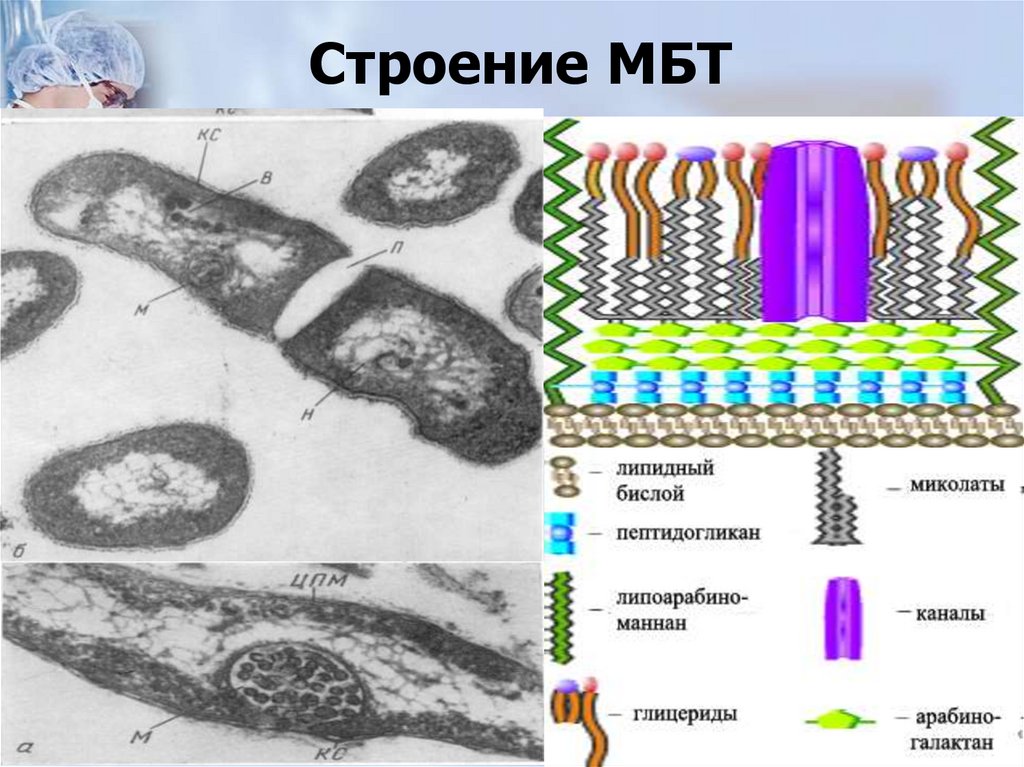Строение МБТ