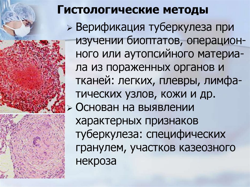 Гистологические методы