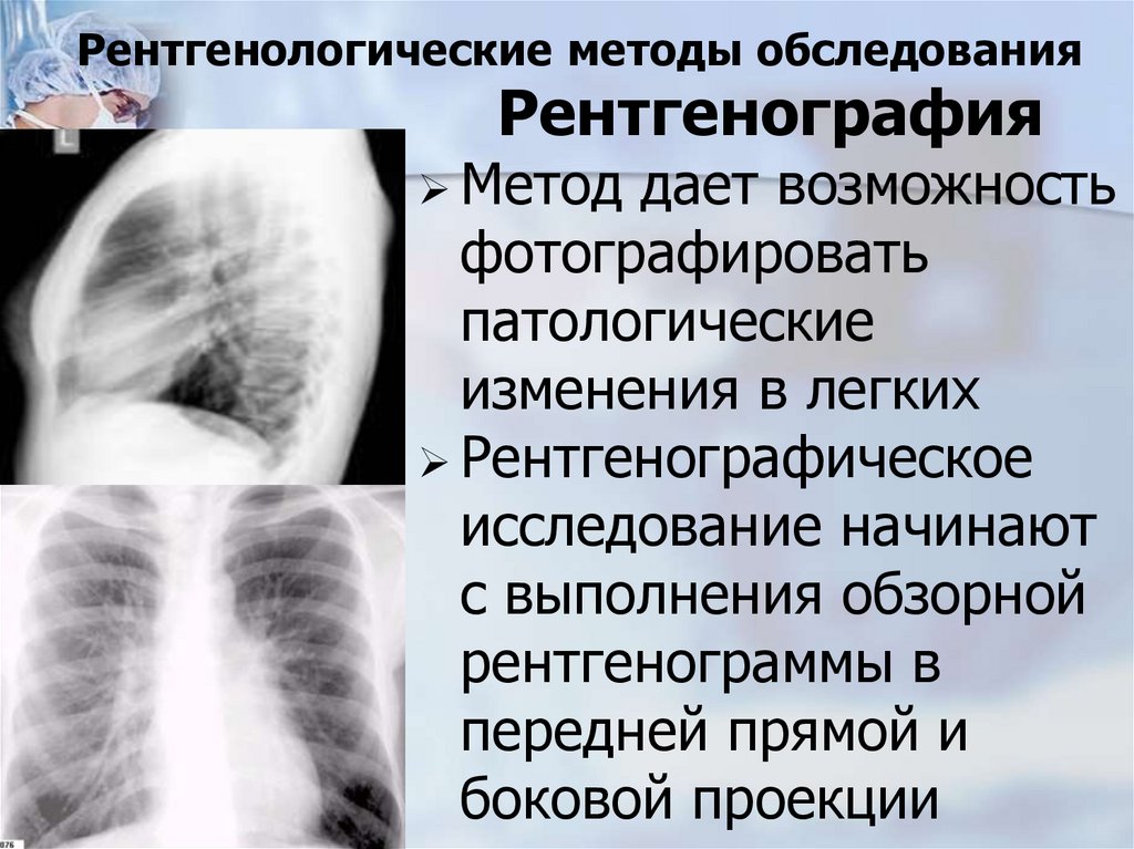 Рентгенологические методы обследования