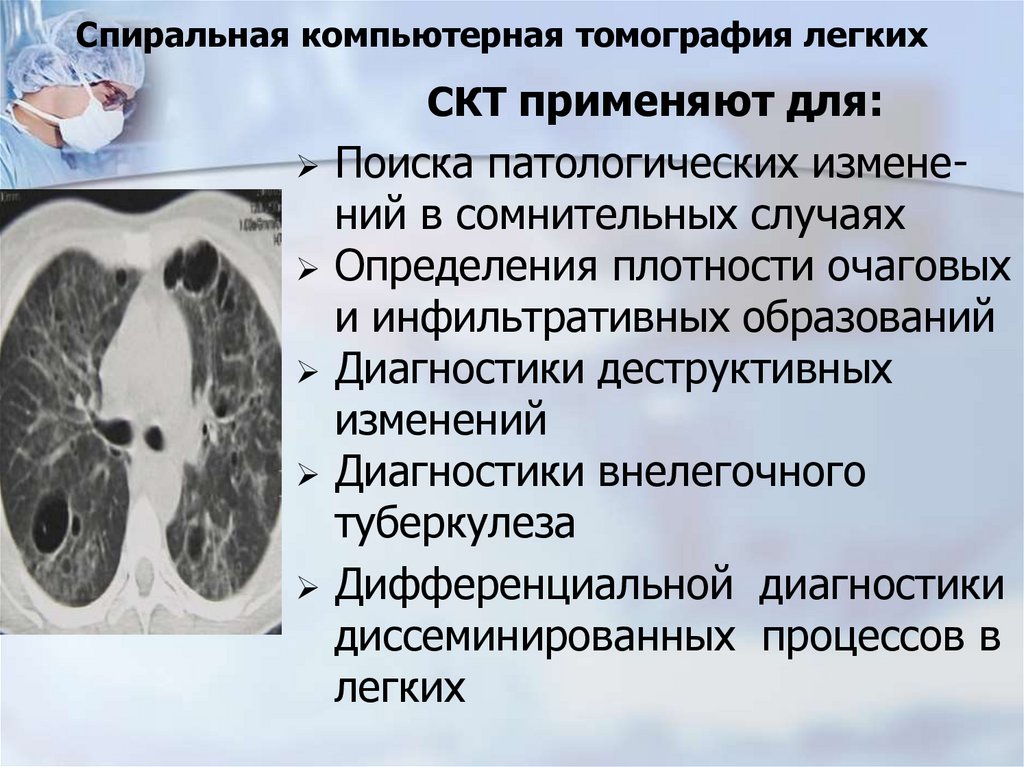 Спиральная компьютерная томография легких