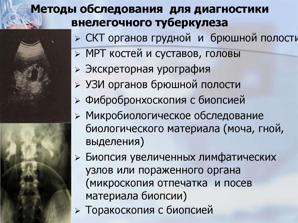 Методы обследования для диагностики внелегочного туберкулеза