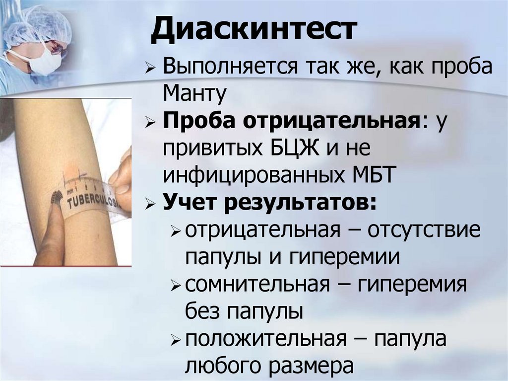 Диаскинтест