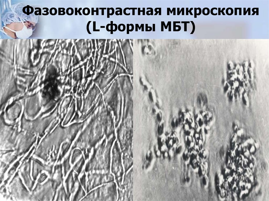 Фазовоконтрастная микроскопия (L-формы МБТ)