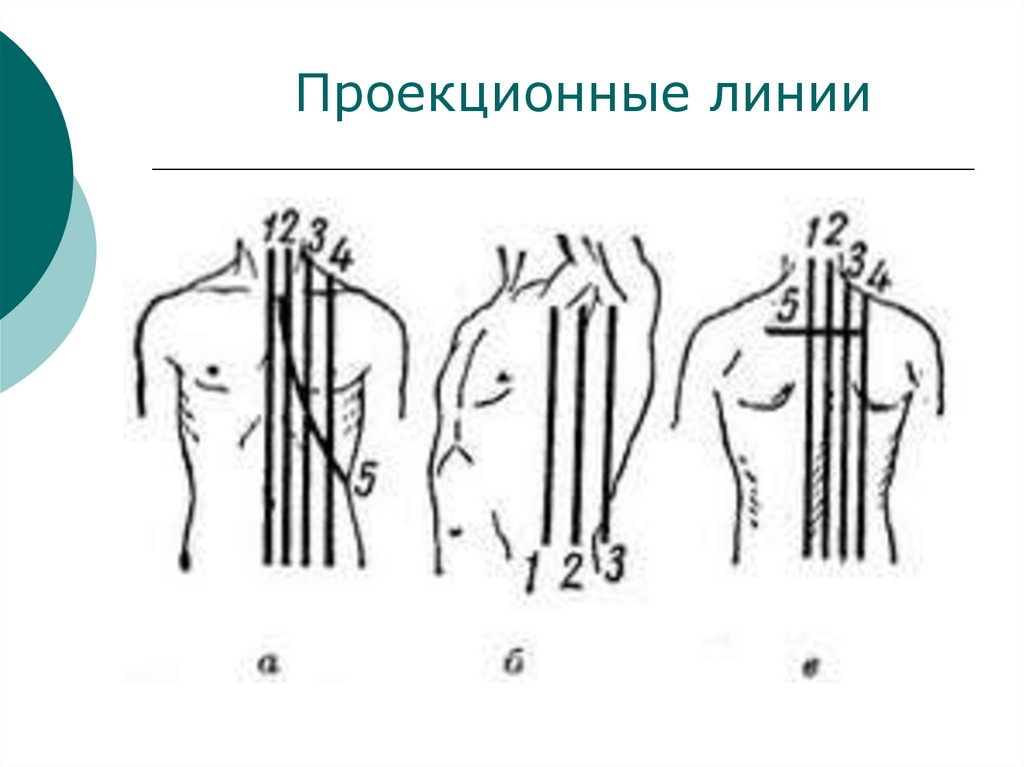 Проекционные линии