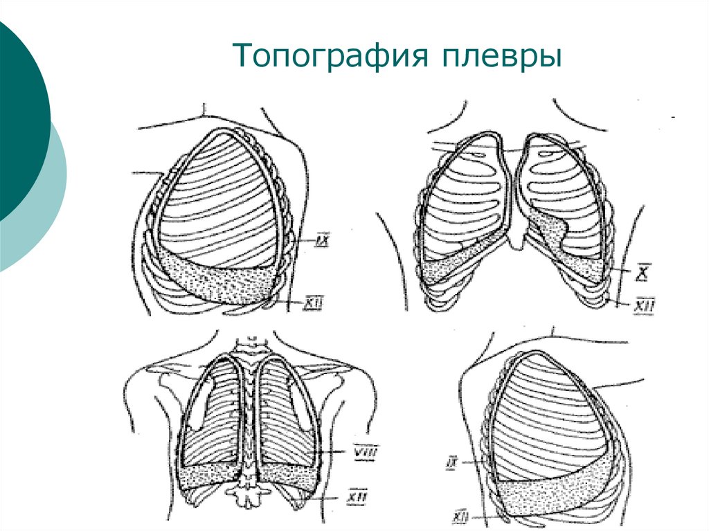 Топография плевры