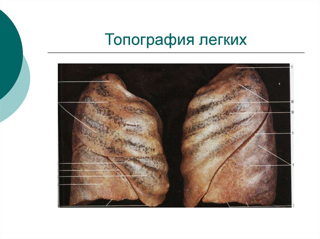 Топография легких