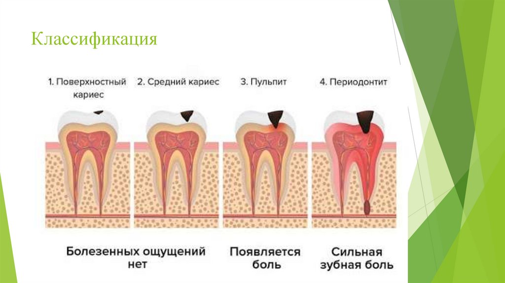 Классификация