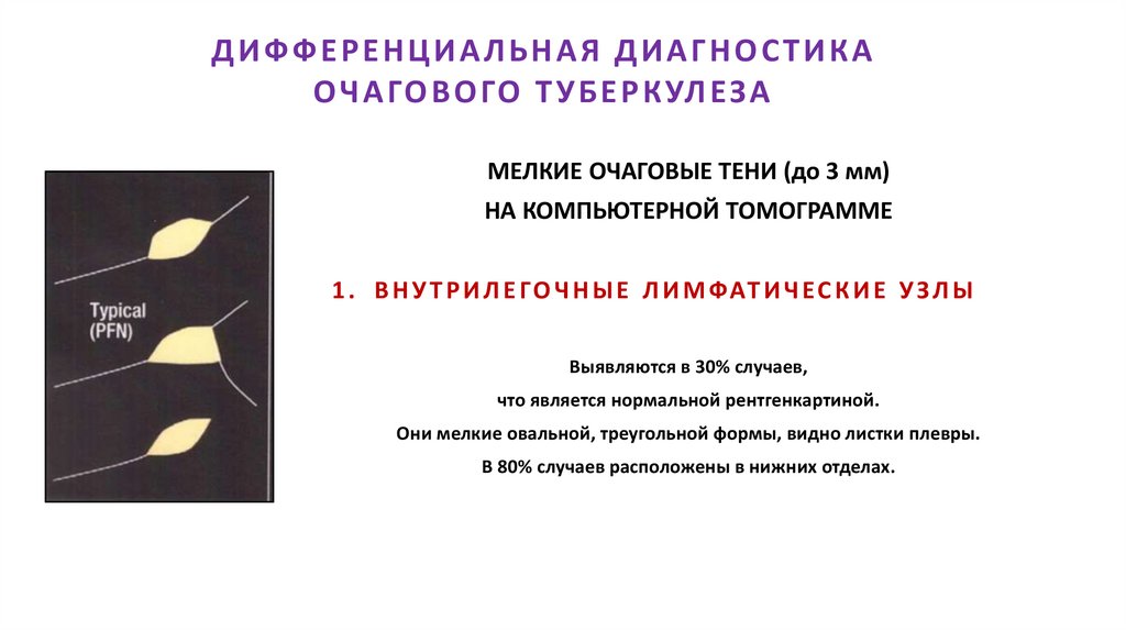 ДИФФЕРЕНЦИАЛЬНАЯ ДИАГНОСТИКА ОЧАГОВОГО ТУБЕРКУЛЕЗА
