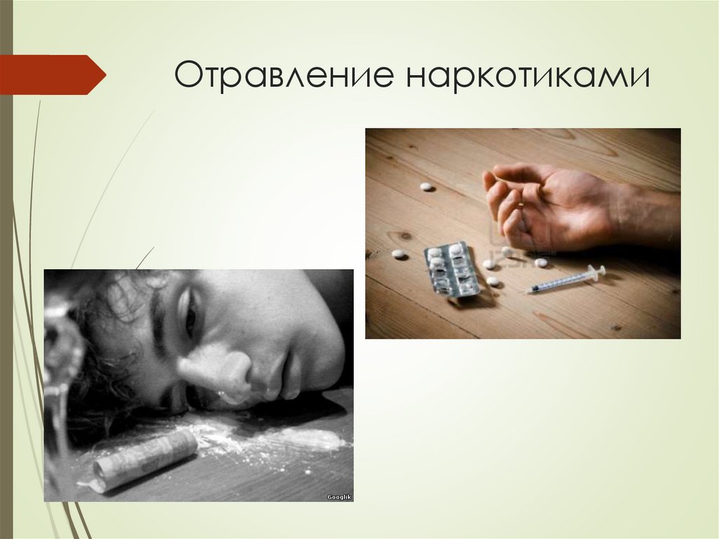 Отравление наркотиками